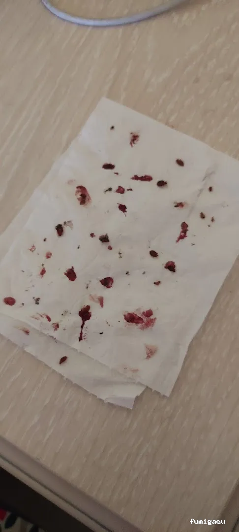 Control de Plagas en Valencia – ¡Fumigación Urgente 24h!