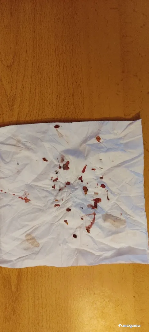 Control de Plagas en Valencia – ¡Fumigación Urgente 24h!