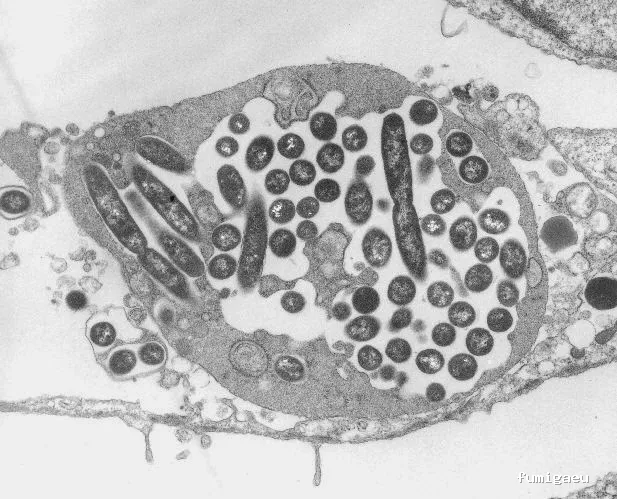 Acción y Control Ambiental, S.L.